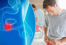 鋸棕櫚 Saw palmetto-男仕之痛 良性前列腺增生 Benign prostatic hyperplasia(BPH),防止脫髮, loss hair,降低前列腺癌 Prostate Cancer